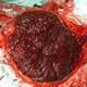Una placenta. Imagen: Wikimedia Commons